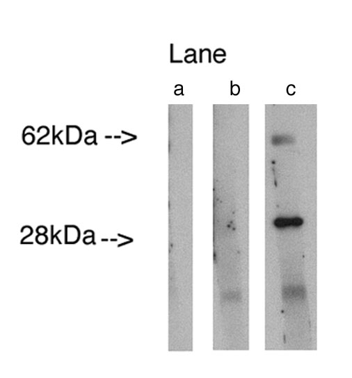 "
Western blot analysis using LAG1 longevity assurance homolog 4 (Cat.# X2298P) at 0.75ug/ml on human lung lysate14 ug/lane.  Lane A] conjugate alone, Lane B] antibody plus 27 ug blocking peptide (Cat. # X2299B ), Lane C] antibody alone. Visualized using Pierce West Femto substrate system.  Anti Rabbit secondary used at 1:3.5K dilution (Cat. # X1207M).  Exposure for 5 minutes"